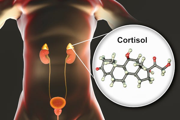 Cómo saber si tengo el cortisol alto